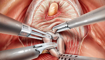 Robotic surgery training